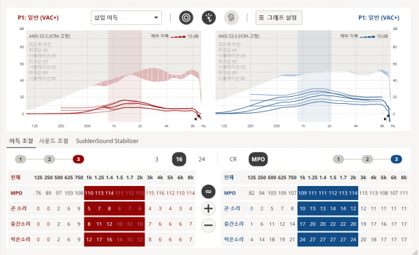 오티콘 인텐트 양쪽 보청기의 이득과 출력 조절 설정 화면